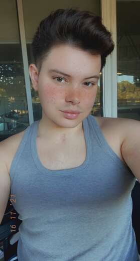 🦿Pretty🥰Young♏️🦂Fem👄DoubleAmputee🦿🦿 - Gay Male Escort in Jacksonville - Main Photo